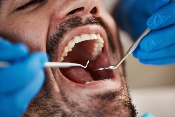 Best Emergency Broken Tooth Repair in Centreville, MD